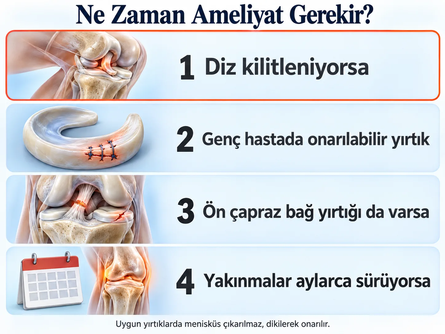 Menisküs yırtığında ne zaman ameliyat gerekir: diz kilitleniyorsa, genç hastada onarılabilir yırtık varsa, ön çapraz bağ yırtığı da varsa ve yakınmalar aylarca sürüyorsa. Uygun yırtıklarda menisküs çıkarılmaz, dikilerek onarılır.