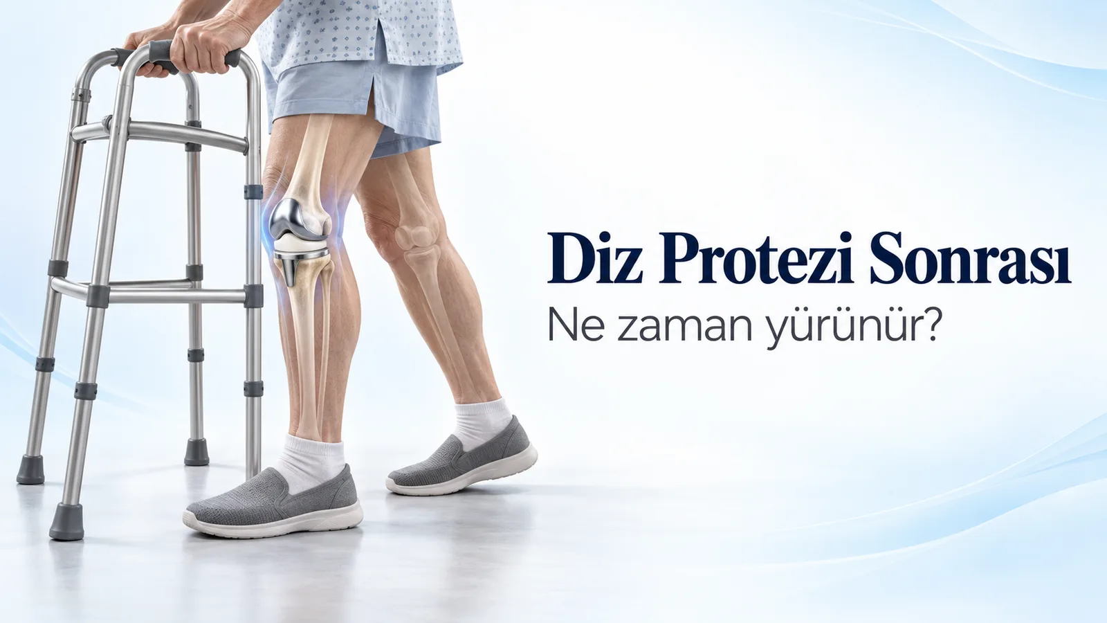Diz protezi sonrası ne zaman yürünür: yürüteçle yürüyen hastanın bacağında, yarı saydam dizin içinde metal bileşenler ve aradaki plastik parçadan oluşan total diz protezi.