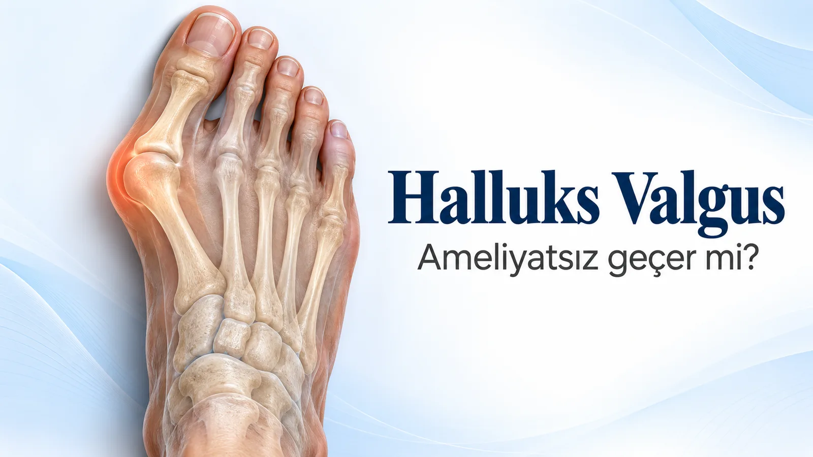 Halluks valgus kapak görseli: sağ ayağın kemikleri üstten görünüyor, başparmak diğer parmaklara doğru eğik ve iç kenardaki çıkıntı turuncu renkle vurgulanmış, yanında “Ameliyatsız geçer mi?” sorusu yazıyor.