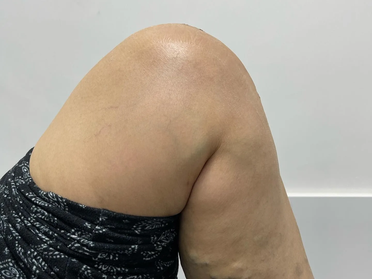 Bükülü dizin yandan görünümü; diz kapağı ve patellar tendon bölgesi.