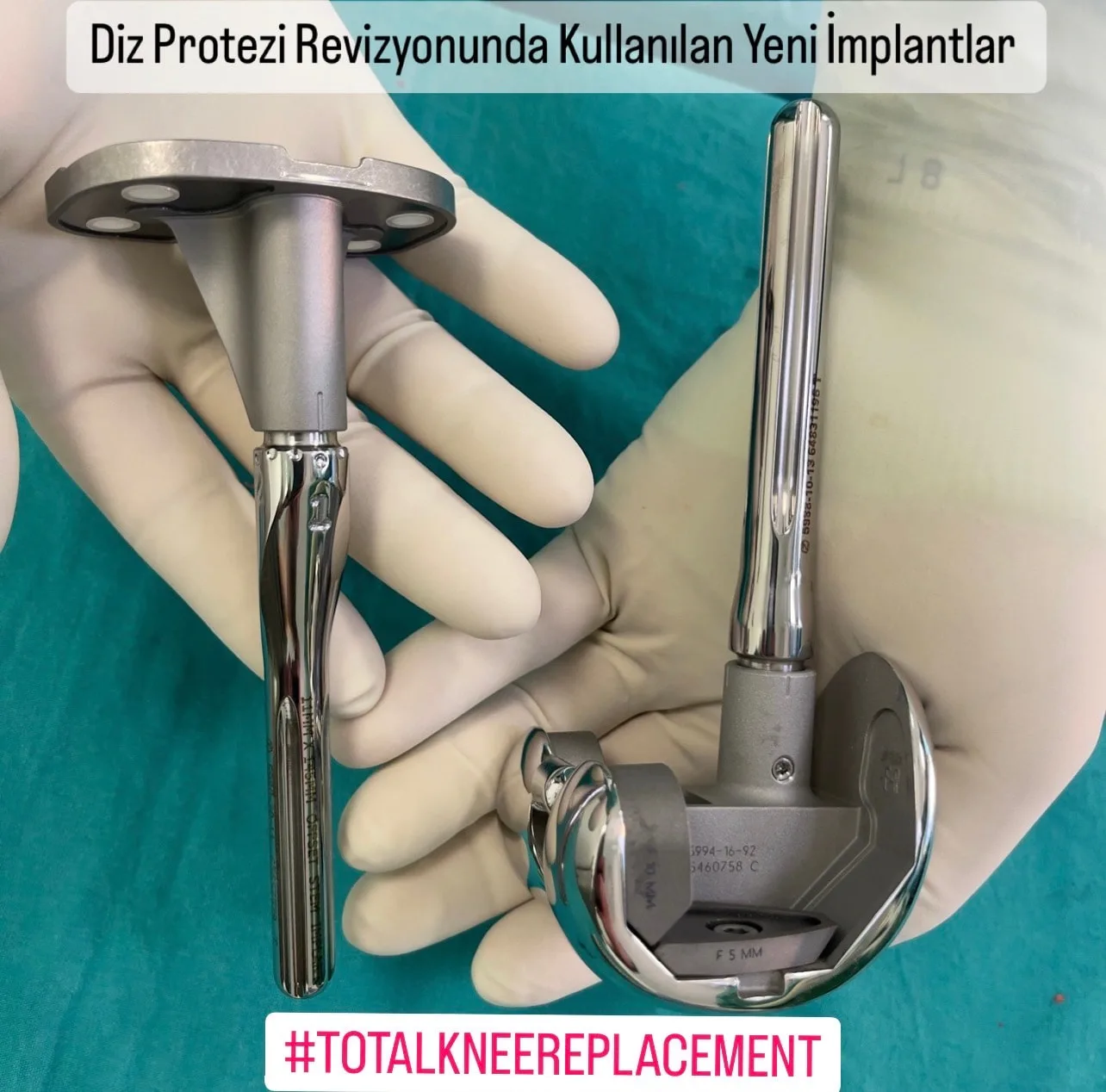 Diz protezi implantları